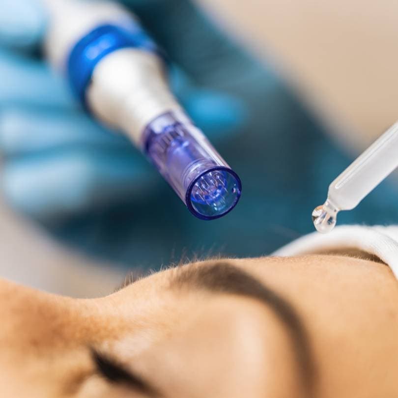 Narbenbehandlung in der Privatpraxis Dr. Ruhnau