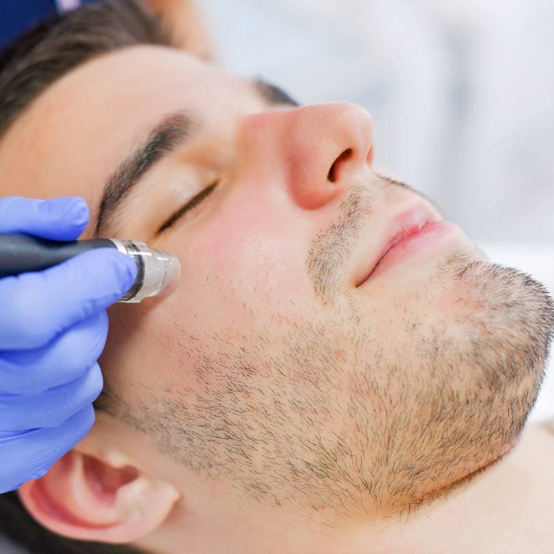 Narbenbehandlung im Ablauf